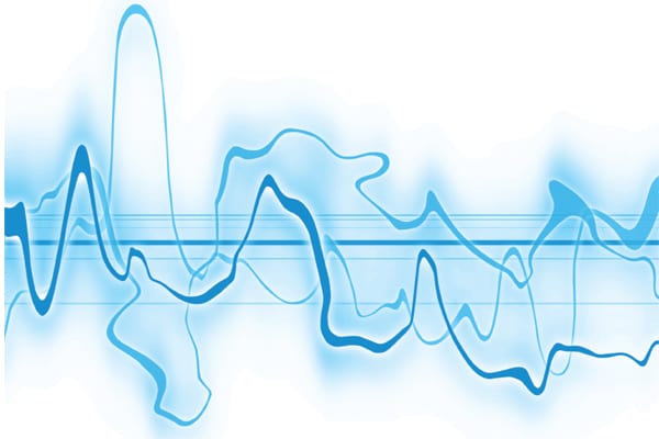 Technology for Treasury Transformation